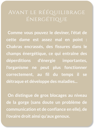 Avant le rééquilibrage énergétique    Comme vous pouvez le deviner, l'état de cette dame est assez mal en point : Chakras encrassés, des fissures dans le champs énergétique, ce qui entraîne des déperditions d'énergie importantes, l'organisme ne peut plus fonctionner correctement, au fil du temps il se détraque et développe des maladies...    On distingue de gros blocages au niveau de la gorge (sans doute un problème de communication et de confiance en elle), de l'ovaire droit ainsi qu'aux genoux.